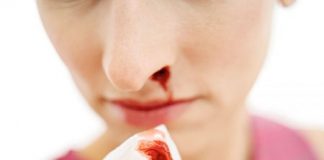 Cách cầm máu khi bị chảy máu cam mùa lạnh
