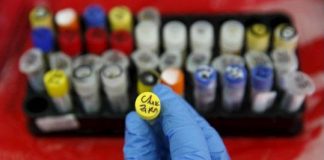 Virus Zika có thể đã phát triển âm thầm từ lâu tại Brazil