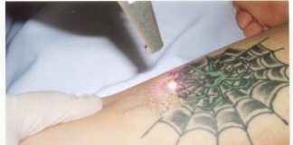 Những chú ý khi chăm sóc da sau xăm