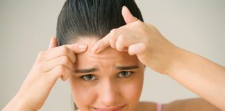 Những nguyên nhân gây mụn trứng cá ở vùng trán