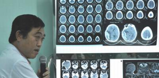 Phương pháp điều trị áp-xe não