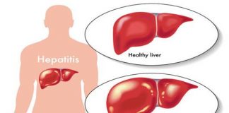 Làm thế nào để bảo vệ gan của bạn ?