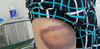 Tưởng gái mại dâm, đánh 2 cái, Công an đền gần 2 triệu