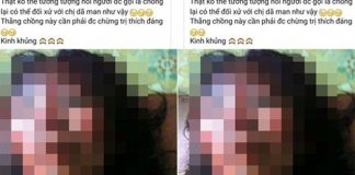 Phẫn nộ: Vợ bị chồng bạo hành, đánh đập dã man