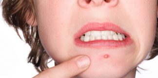 Dấu hiệu gan bị nhiễm độc cần nên đào thải độc tố