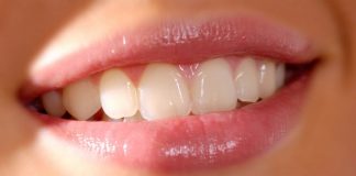 12 kiến thức cơ bản về răng bạn cần biết 1