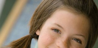 Cách loại bỏ tàn nhang