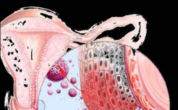 Bệnh sùi mào gà và biến chứng - 1