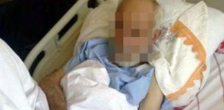 Lần đầu đi mua dâm, cụ ông 80 dính sùi mào gà