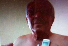 Bỗng thành người “nam châm” sau ca phẫu thuật Bỗng thành người “nam châm” sau ca phẫu thuật