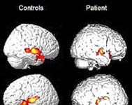 Chơi quần vợt khi hôn mê