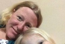 Pin cúc áo - "Sát thủ" nguy hiểm đối với trẻ nhỏ