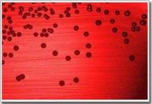 Vi khuẩn mặc "áo tàng hình" trốn khỏi hệ thống miễn dịch của con người