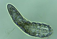 Vẻ ngoài đáng sợ của loài ký sinh trùng trên da mặt con người