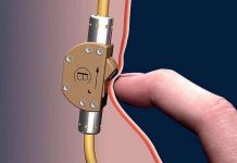 Thợ mộc Đức phát minh van khóa tinh trùng