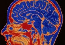 Những điều kinh ngạc về não người