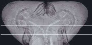 Bắt được bào thai cá mập 2 đầu