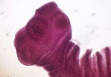 8 loại ký sinh trùng có nguy cơ lẩn trốn trong thức ăn bạn ăn hàng ngày