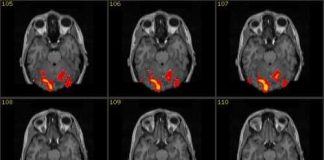 Những bí ẩn về khuôn mặt con người