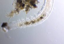 Cảnh tượng giun ăn tảo phóng đại 250 lần Cảnh tượng giun ăn tảo phóng đại 250 lần