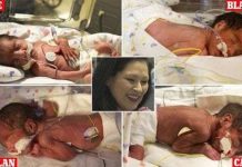 Những chuyện lạ có thật về các cặp song sinh