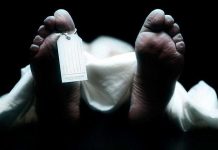 Điều gì xảy ra khi bạn hiến tặng cơ thể mình cho khoa học sau khi qua đời?