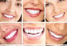 Tự tin với nụ cười nhờ công nghệ nano