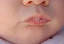 Tìm ra chất giảm đau mạnh hơn morphine 6 lần