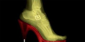 Đi giày cao gót - đau đớn vì cái đẹp