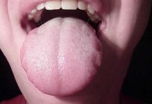 Bạn sẽ không thể tin nổi những hình ảnh kinh khủng này chính là cơ thể bạn