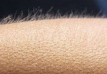 Những phản ứng kỳ lạ của cơ thể với cái lạnh