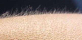 Những phản ứng kỳ lạ của cơ thể với cái lạnh