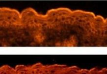 Phát hiện gen điều khiển sự hình thành da