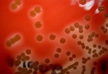 Vi khuẩn mới trong lỗ mũi sẽ đưa nhân loại vượt qua thời đại kháng kháng sinh Vi khuẩn mới trong lỗ mũi sẽ đưa nhân loại vượt qua thời đại kháng kháng sinh