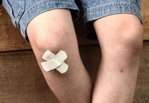 Băng y tế có khả năng làm lành vết thương bằng cách... hút vi khuẩn