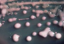 Bùng phát loại siêu vi mới kháng thuốc