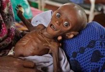 Hạn hán ở Châu Phi: Bé 7 tháng tuổi cân nặng bằng trẻ sơ sinh Hạn hán ở Châu Phi: Bé 7 tháng tuổi cân nặng bằng trẻ sơ sinh