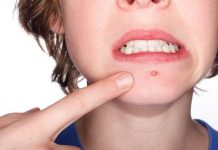 Vì sao vi khuẩn chỉ gây mụn ở một số người? Vì sao vi khuẩn chỉ gây mụn ở một số người?