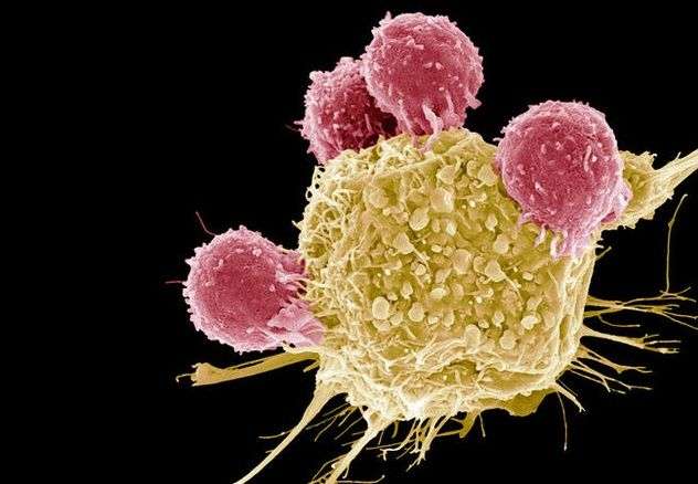 Kết hợp 2 phương pháp truyền thống, các nhà khoa học có thể đánh bại ung thư