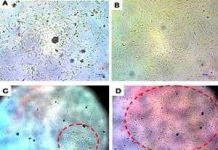 Máu ở phụ nữ: Nguồn tế bào gốc mới