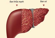 Hàng loạt virus gây bệnh viêm gan, hầu hết chúng ta không biết