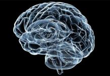 Mũ cảnh báo đột quỵ