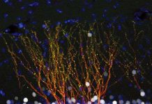 Phát hiện mới về virus cổ đại giúp hiểu rõ hơn về HIV Phát hiện mới về virus cổ đại giúp hiểu rõ hơn về HIV