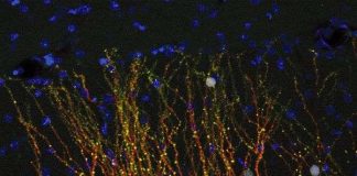 Phát hiện mới về virus cổ đại giúp hiểu rõ hơn về HIV