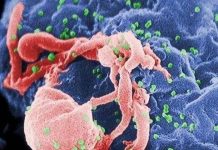 Cảm biến phát hiện virus HIV bằng mắt thường