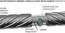 Robot thăm dò bụng người