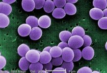 Tụ cầu vàng - "đương kim vô địch" kháng thuốc kháng sinh