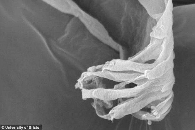 Phát hiện ra cơ chế hút, truyền bệnh chết người của ruồi xê xê