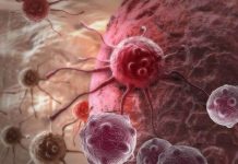 Kết hợp 2 phương pháp truyền thống, các nhà khoa học có thể đánh bại ung thư Kết hợp 2 phương pháp truyền thống, các nhà khoa học có thể đánh bại ung thư