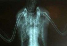 Bức ảnh lạ: 'Người ngoài trái đất' trong mề chim